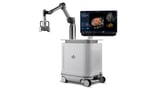 ECU Health Medical Center performs its first procedure with Edison® Histotripsy System