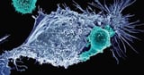 HLB unit touts US trial gains as CAR-T shrinks solid tumors up to 47% - CHOSUNBIZ