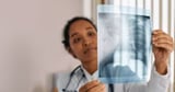 Digital Health Outreach Improves Lung Cancer Screening