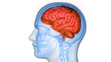 Senescent Cells, Osteoporosis, and Alzheimer's Are Linked