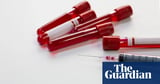 New blood test could help spot children at risk of serious illnesses, study finds