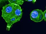 How the evolution of a single gene allowed the plague to adapt, prolonging the pandemics