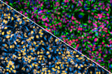 Scientists Create Cell Villages to Map Brain Genetics