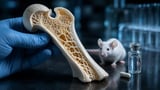 Repurposed cancer drug could reverse bone loss, weight gain post-menopause