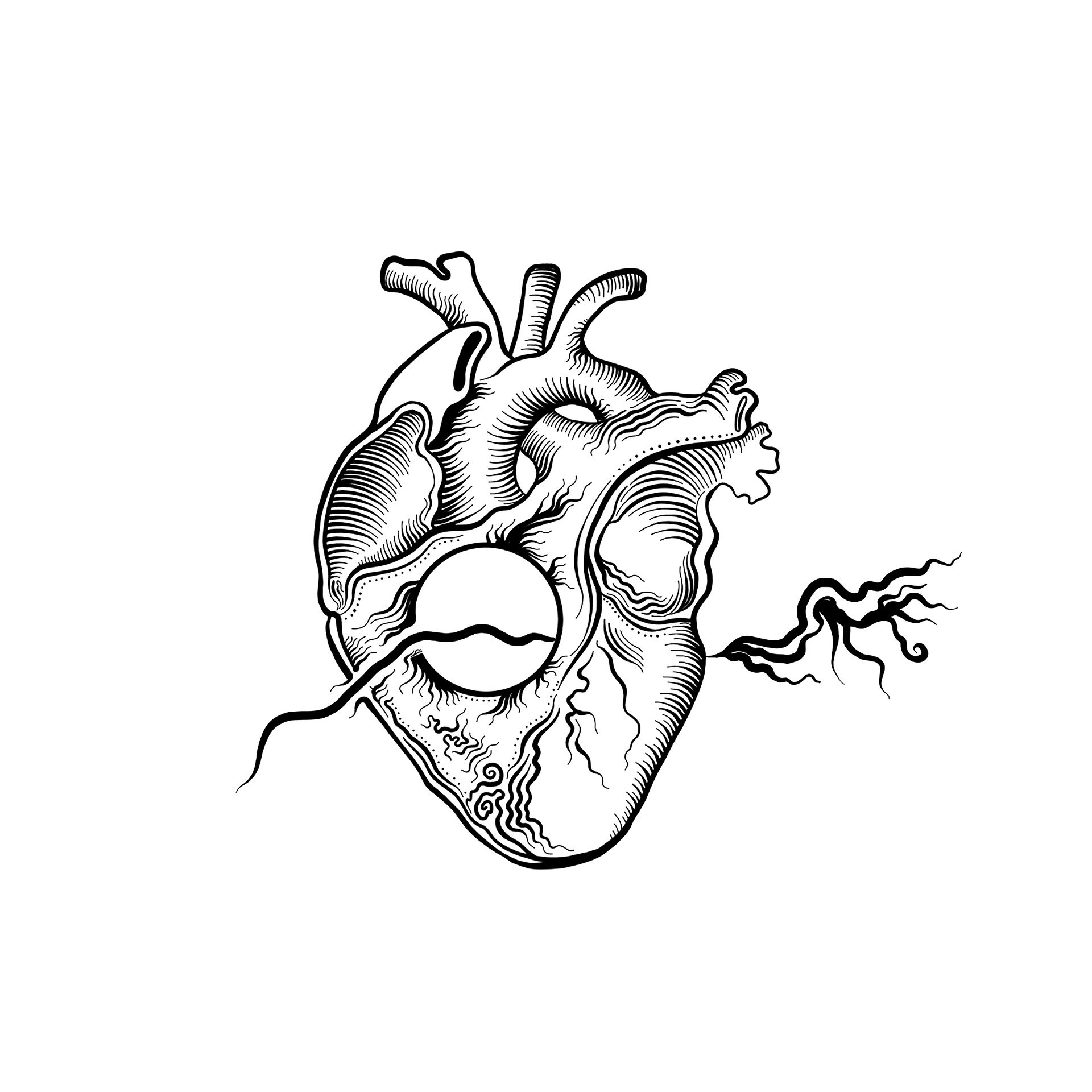 Transcatheter edge-to-edge repair found non-inferior to surgery in patients with secondary mitral regurgitation