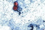 The US's iceberg lettuce cyclospora outbreak is declared over | AP News