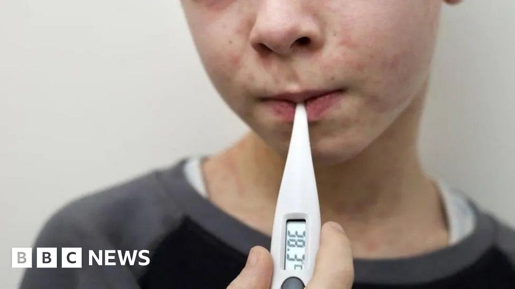 Parents warned of back-to-school measles surge