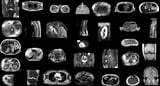 AI model automatically segments MRI images, reducing radiologist workload