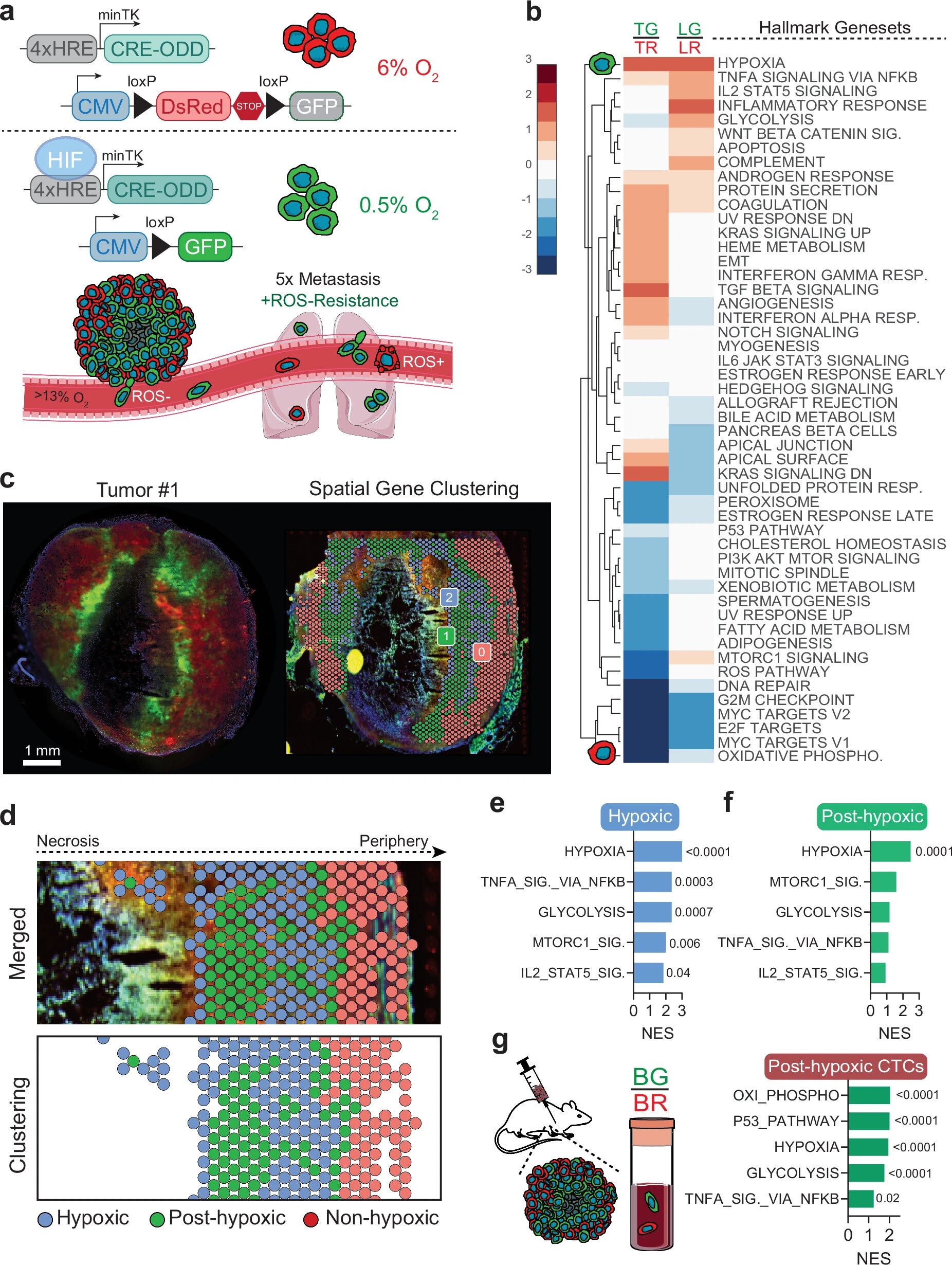 How hypoxia helps cancer spread: Scientists identify 16 genes that aid cancer cell survival in low-oxygen regions