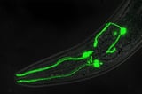 Taking a 'one in a million' shot to tackle dopamine-linked brain disorders