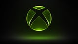 New Xbox Hardware Leaks, And It Looks Wildly Different