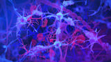 Chronic gut infection could play a role in Alzheimer's development