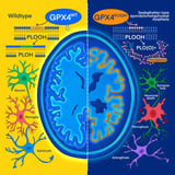 Single enzyme failure found to drive neuron loss in dementia