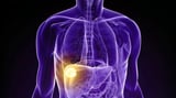 UCLA Study Identifies Key Protein that Helps Liver Cancer Resist Heat-Based Treatment - OncoDaily