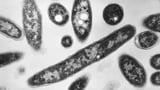 Legionnaires’ disease in New York City: 4th person dies after dozens sickened in Harlem | AP News