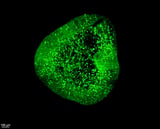 Detailed map of the developing human brain opens new pathways for Parkinson's treatment