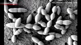 Researchers find gut bacteria that makes anticancer drugs work better in mice