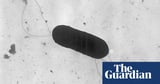 At least 10 people sickened in US listeria outbreak linked to prepared foods