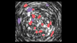 'Brain dial' for controlling food, fat and salt cravings found in mice
