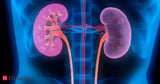 AI detected rare kidney disease, saved man from certain death