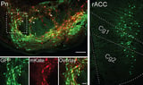 Neuroscientists discover brain circuitry of placebo effect for pain relief