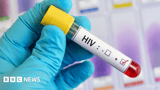 Wolverhampton HIV tests encouraged as campaign launches