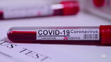 South Florida marketer convicted in $15M COVID testing scheme targeting seniors