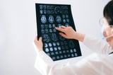 First successful treatment of pediatric high-risk refractory neuroblastoma with PARP inhibition