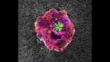 In a First, Scientists Capture Human Embryo Implantation in Real Time