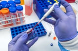 New Blood Test Added to Colorectal Cancer Screening Recommendations as Disease Spikes in Young People