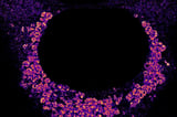 A new way to see viruses in action: Super-resolution microscopy provides a nano-scale look