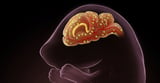 Researchers Offer New Insights on Cells that Build Protective Brain Barriers