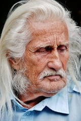 Dry eyes affect over half the general population, yet only a fifth receive diagnosis and treatment
