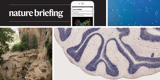 Daily briefing: Evidence grows that cows spread bird flu through their milk