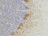 How multiple sclerosis harms a brain long before symptoms appear