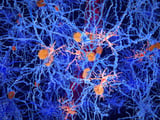 Study linking depression to specific altered brain cells opens door to new treatments