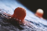 New Blood Test Spots Cancer up to 3 Years Before Symptoms Emerge