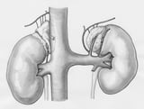 Vaccinated patients with COVID-related kidney injury face lower dialysis and death risks