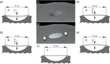 A Lunar Base Could Start with a Dome over a Crater Made of Regolith