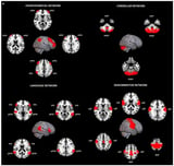 Evaluation of Intra- and Inter-Network Connectivity within Major Brain Networks in Drug-Resistant Depression Using rs-fMRI