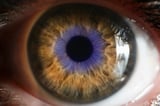 Atsena eye disease gene therapy hits safety goals, closes retinal splits in phase 1/2