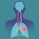 Are lung cancer tumors hijacking the nervous system? - Salk Institute for Biological Studies