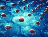 Stem cell therapy restores brain function after stroke