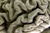 A blood test may predict the start of Alzheimer's symptoms years in advance | AP News