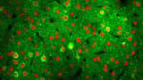 Neighborly help in the brain: Cerebral cortex networks rapidly reorganize to compensate for lost neurons