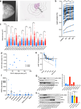 Tumor cell-adipocyte gap junctions activate lipolysis and contribute to breast tumorigenesis