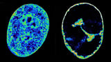 See how the herpesvirus reshapes our cells’ DNA in just eight hours