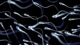 At least 197 children were fathered by sperm donor with cancer-causing gene. Some have already died