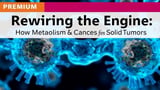 Rewiring the Engine: How Metabolism Could Unlock CAR-T Cells for Solid