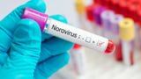 CDC reports increase in norovirus cases: What to know about the stomach flu